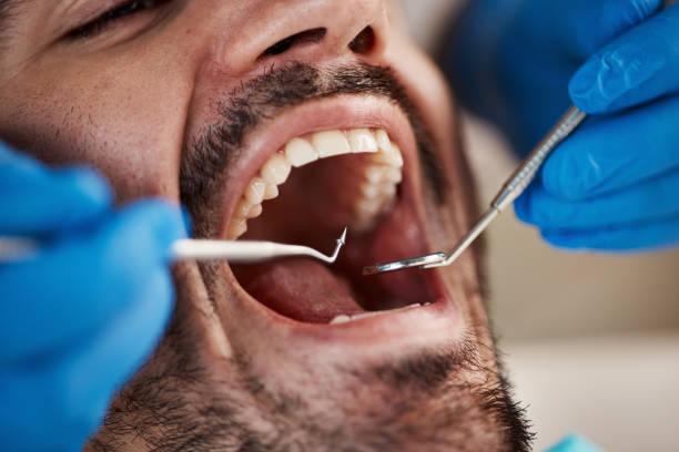 Best Emergency Dental Surgery in Lake Darby, OH