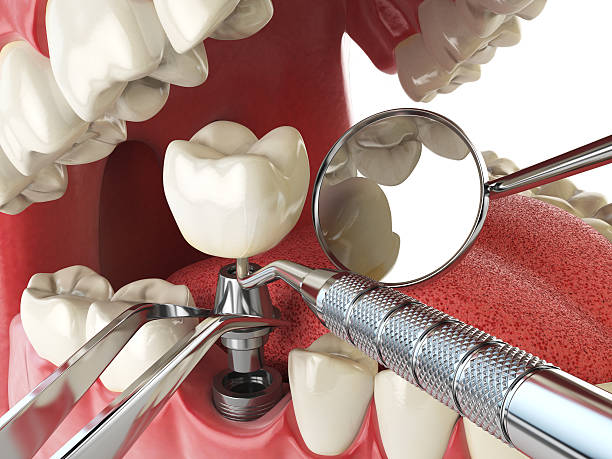 Best Pediatric Emergency Dentist in Lake Darby, OH